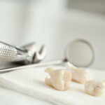 managing pain after tooth extraction