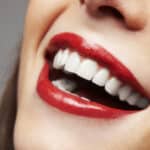 How Veneers Can Improve the Appearance of Your Smile