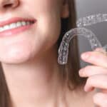 aligners for aligning teeth