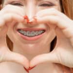 A woman with braces is holding her fingers, forming a heart in front of her face.