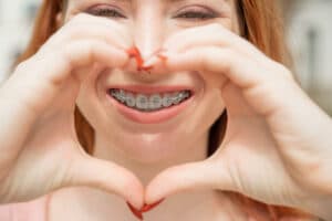 A woman with braces is holding her fingers, forming a heart in front of her face.